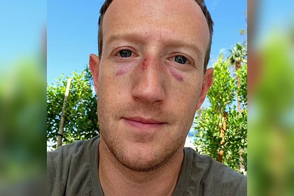 Избитый Марк Цукерберг поделился селфи с синяками под глазами